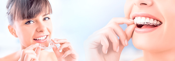 Pessoas sorrindo após tratamento dentário